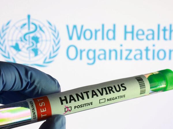 ÜST-dən hantavirusla bağlı XƏBƏRDARLIQ
