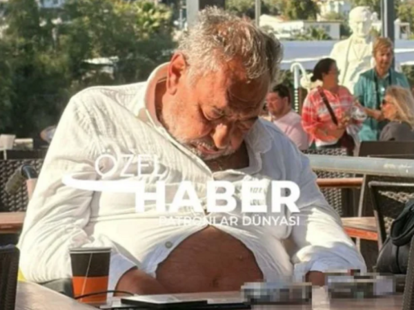 Televiziya ulduzunun son halını görənlər tanıya bilmir - <span class="color_red">FOTO</span>
