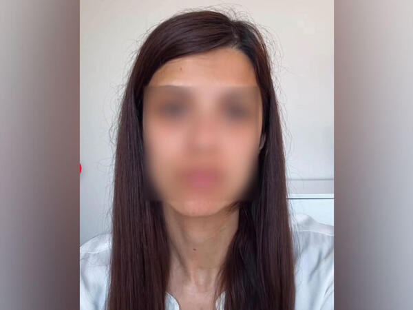 Dənizkənarı Milli Parkda qadına hücum - Üstündən 3 bıçaq çıxdı