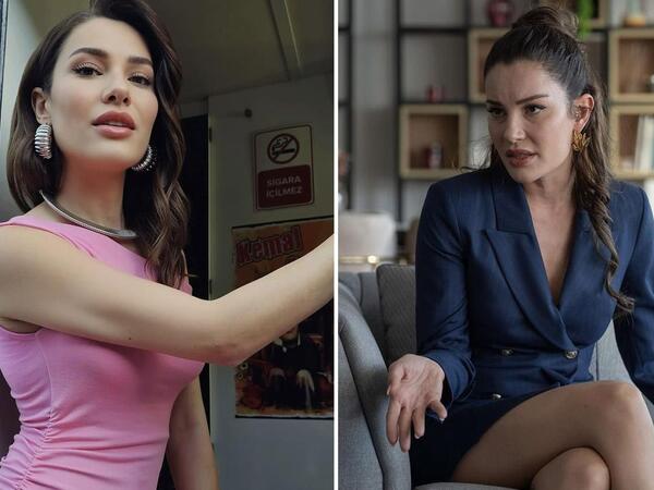 Ecenin ölümü ilə bağlı yeni detal: Aktrisa meymun dişləməsindən vəfat edib?