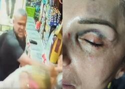 Bakıda kişi qadını mağazada döydü - Saxlanıldı <span class="color_red">(Video)</span>