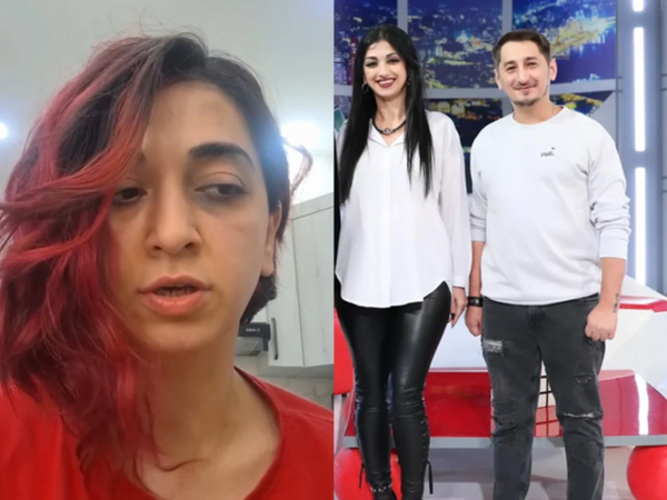 Azərbaycanlı müğənni küçədə döyüldü - <span class="color_red">(Foto/Video)</span>