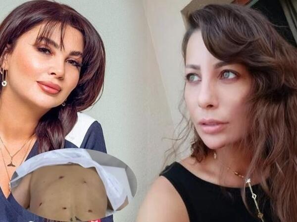 Aktrisaya görə Ülviyyə İlyasovanın cəzası artırıldı