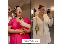 Arıqlayaraq tanınmaz dərəcədə dəyişən məşhurlarımız – Kimə daha çox yaraşıb? - <span class="color_red">(Fotolar)</span>
