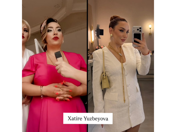 Arıqlayaraq tanınmaz dərəcədə dəyişən məşhurlarımız – Kimə daha çox yaraşıb? - <span class="color_red">(Fotolar)</span>