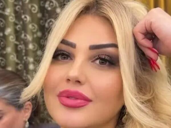 Bakıda dişini çəkdirən qadın öldü