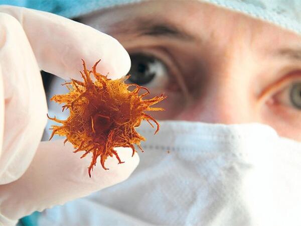 Xərçəngə səbəb ola bilən bakteriya bu imiş - Diqqətli olun