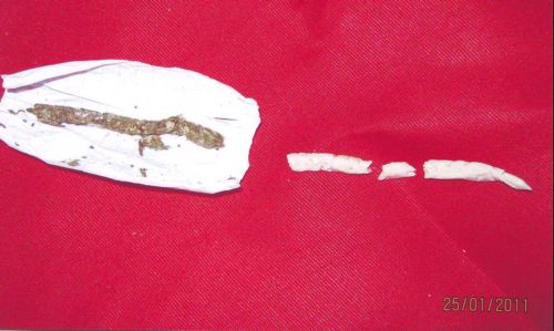 Qobustan həbsxanasına göy soğanın içərisində heroin keçirmək cəhdi - FOTO-YENİLƏNİB