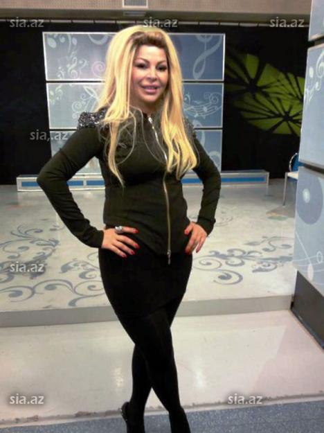 Aygün Kazımova yaxşı saxtakarlıqla üz-üzə - FOTOSESSİYA
