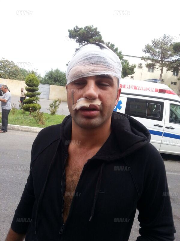 "Oazis" qurbanları: "Rəqs edərkən yaxınlaşıb ki, bura fahişəxanadır?" - VİDEO - FOTO