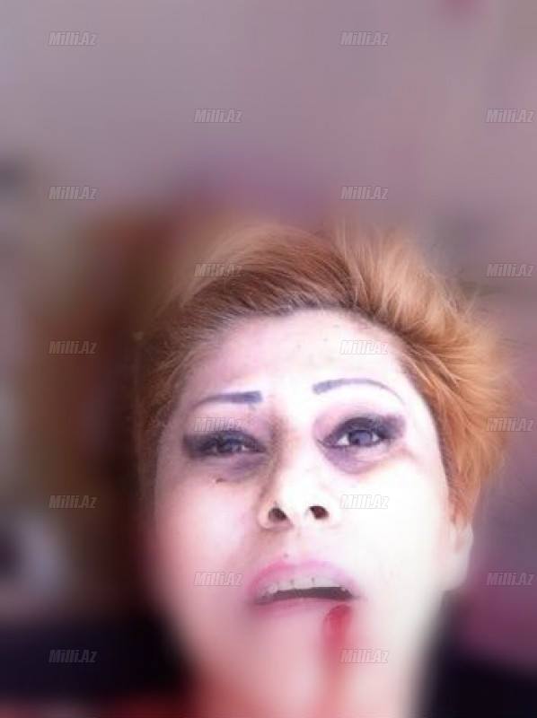 Bakıda qadına Sevgililər Günü 20-yə yaxın bıçaq niyə vuruldu? - FOTO