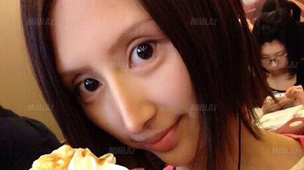 "Gözəllik eşqi" onu bu hala saldı - FOTO