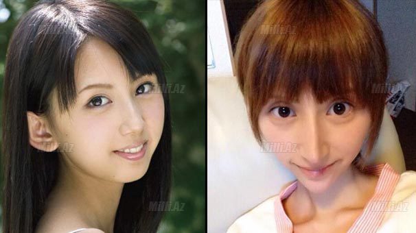 "Gözəllik eşqi" onu bu hala saldı - FOTO