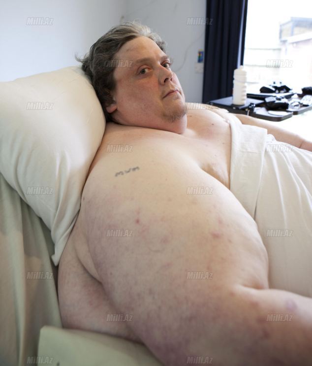 Keith Martin - World's Fattest Man