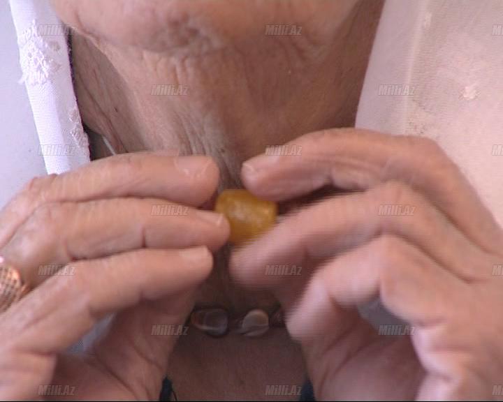 Kəhrəba daşı və zob xəstəliyi - FOTO