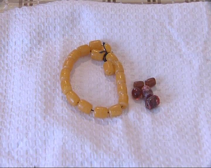 Kəhrəba daşı və zob xəstəliyi - FOTO