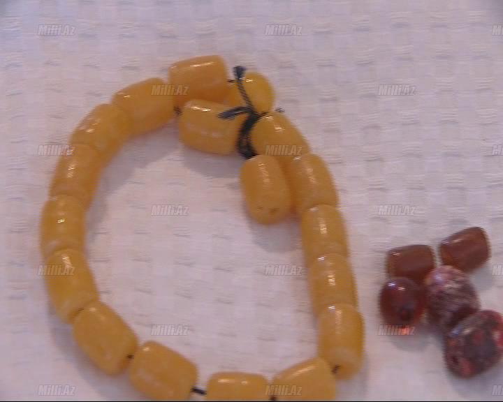 Kəhrəba daşı və zob xəstəliyi - FOTO